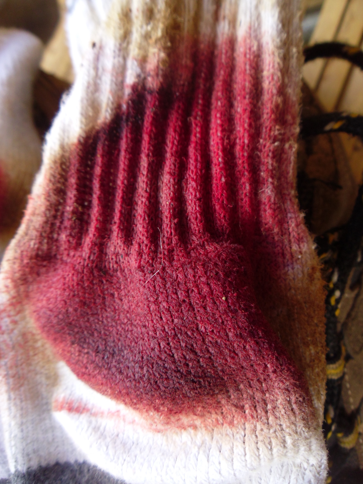 Blood-drenched sock